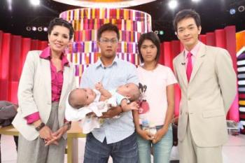 รูปน้องปิ่นน้องปานแฝดสยาม มาดูกาน